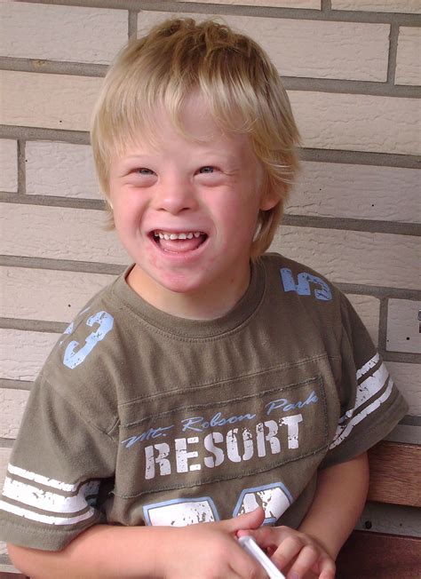 File:Boy with Down Syndrome.JPG - Wikimedia Commons