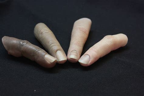 Why Custom Finger Prostheses? - fingerprosthetics.com