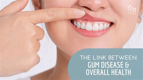 Exploring The Relationship Between Gum Disease And Overall Health