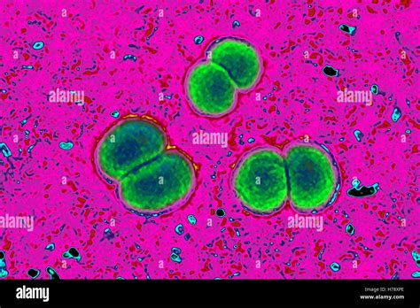 Neisseria Meningitidis Fotografía De Stock Alamy