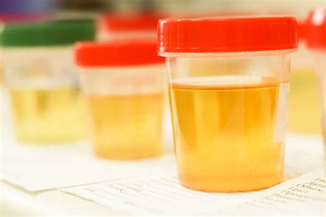warna urine ibu hamil muda