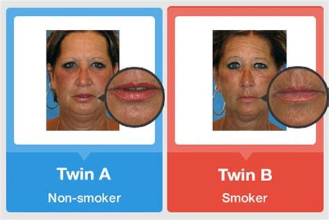 Difference Between Smokers Vs Non Smokers Photos