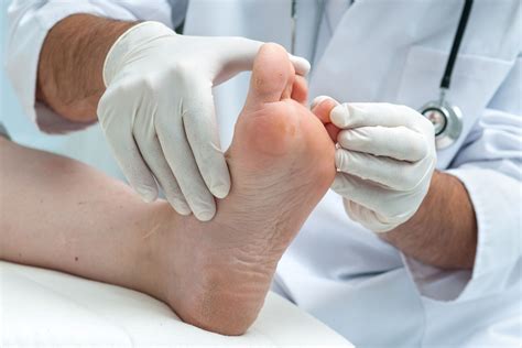 Diabetes How To Examine Your Feet Podiatry Center Of New Jersey