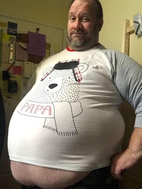Fat Man Tits Causes Treatment And Prevention