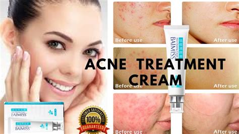 Best Acne Treatment Cream Acne Treatment For Men Acne Treatment For