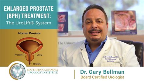 Socal Urology Institute Performs Urolift Procedure For Enlarged Prostate Youtube