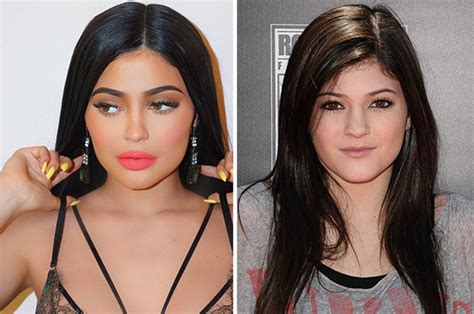 Here's what kylie jenner looked like before veneers. Kylie Jenner before surgery: Plastic surgeon gives verdict ...