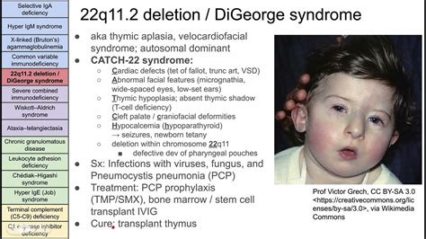 Primary Immunodeficiency Disorders Youtube