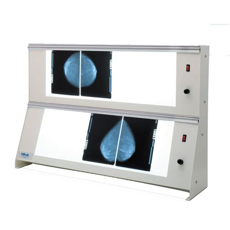 2 Screen X Ray Film Viewer M Nm 01 Cablas For Mammography White