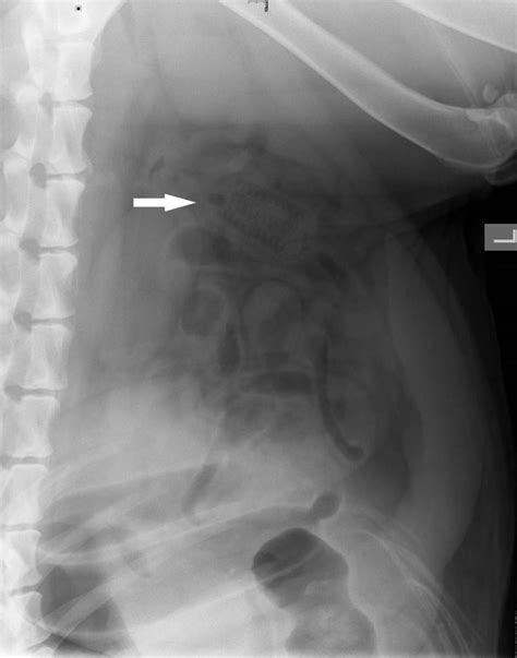 Intestinal obstruction is a serious pathology, consisting in the complete violation of the passage of the contents through the intestine. Image: Intestinal obstruction, lateral view, dog - Merck ...