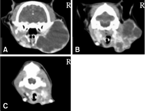 Post Contrast Ct Images Showing Enlargement Of The Right Submandibular