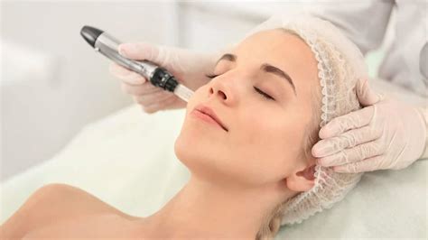 What Are The Benefits Of Micro Needling Treatment Equaliser