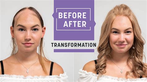 Alopecia Areata A Wig For A 13 Year Old Transformation With Hey2go