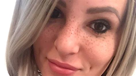 People Are Seriously Getting Freckles Tattooed On Their Faces Freckle