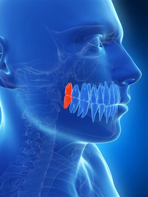 Wisdom Teeth Removal Stonebridge Dentalmckinney Tx Dentistry Your