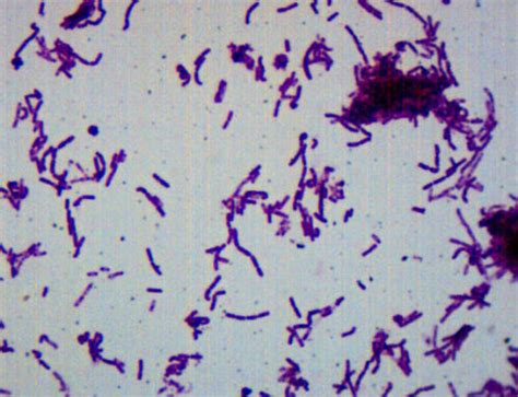 25pk Bacillus Smear Gram Prepared Microscope Slides 75x25mm