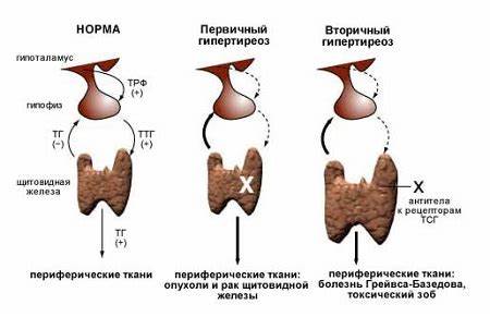 Диета при гипотиреозе у мужчин