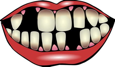 Mimpi gigi sakit atau tertanggal itu katanya peringatan atau petanda suatu perkara buruk akan menimpa. 5 Arti Mimpi Tentang Gigi, Satu Diantaranya Mimpi Gigi ...