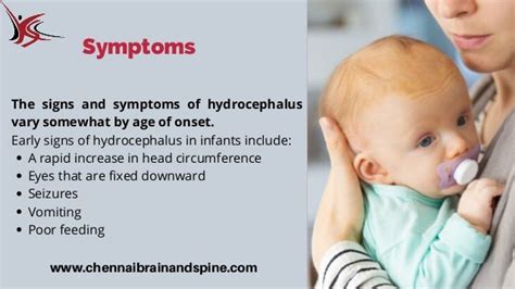 Hydrocephalus Symptoms Causes And Management