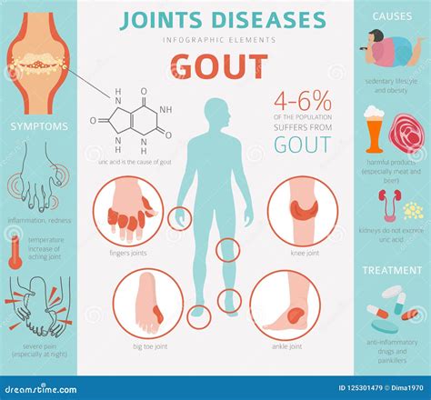 Joints Diseases Gout Symptoms Treatment Icon Set Stock Vector