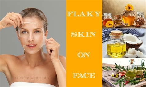 18 Home Remedies How To Treat Flaky Skin On Face Treatment