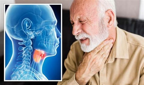 Throat Cancer Changes In Your Gums That Last ‘more Than 2 Weeks Could