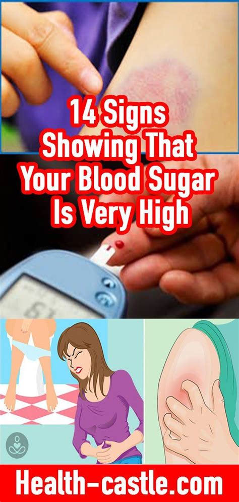 Pin On Diabetes