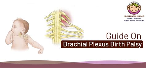 Everything You Need To Know About Brachial Plexus Birth Palsy