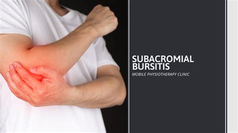 Shoulder Impingement And Subacromial Bursitis Physiot