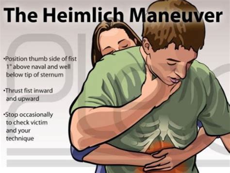 Henry Heimlich Who Invented The Heimlich Manoeuvre Dies Aged 96