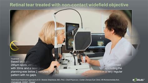 Read about retinal detachment surgery, symptoms, treatment, and causes. Laser retinopexy: Non-contact navigated laser treatment of ...