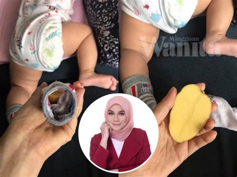 Ini adalah petua hilangkan batuk bayi menggunakan bahan yang ada di dalam dapur iaitu kentang. Mak-mak Petua Letak Kentang Dalam Stoking, Mujarab Redakan ...