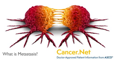 What Is Metastasis Cancernet