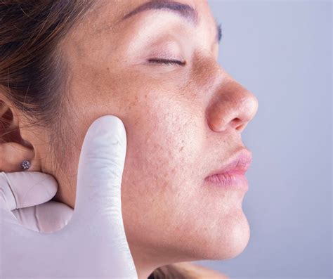 Dermatologists In Lucknow Skin Specialist In Lucknow