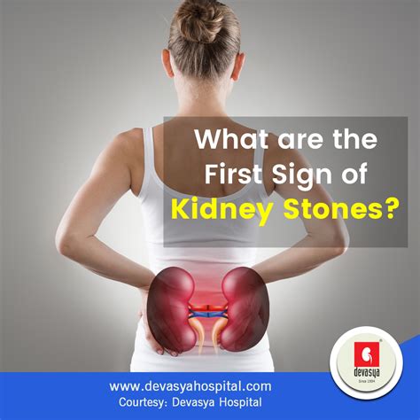 Kidney Stone Pain Location