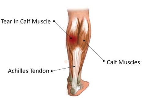 From your description, i would guess it would be the calf muscle. Calf Strain - RehabExercise.org