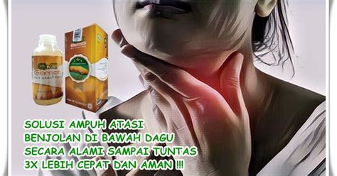 Kak ini kucing saya di bagian bawah perut nya kok ada benjolan tpi lunak, untuk obat nya apa ya dok? Cara Menghilangkan Benjolan Di Bawah Dagu Tanpa Operasi ...