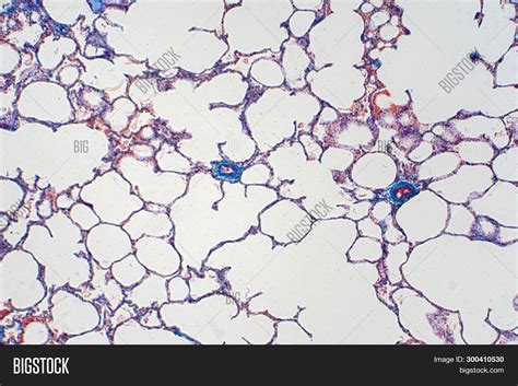 Human Lung Tissue Under Microscope View Lungs Are The Primary Organs