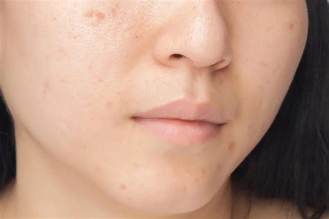 Signs Your Skin Products Are Bad For Your Skin The Healthy