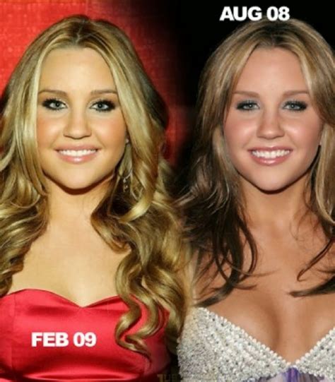 Amanda Bynes Plastic Surgery Before And After Nose Jobs And Breast Implants Pictures