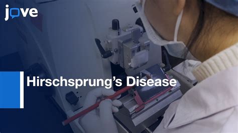 hirschsprung s disease diagnosis by staining rectal section biopsy protocol preview youtube