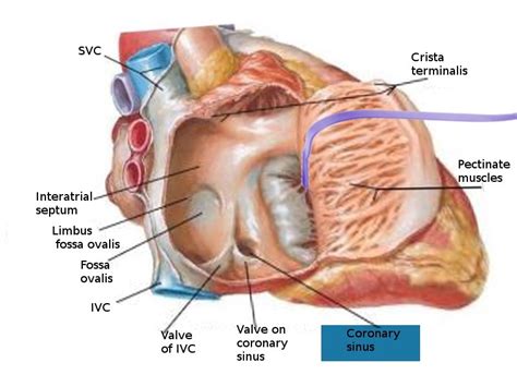 Figure Coronary Sinus Opening Image Courtesy S Bhimji Md Statpearls Ncbi Bookshelf