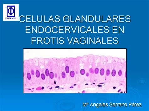 Ppt Celulas Glandulares Endocervicales En Frotis Vaginales Powerpoint