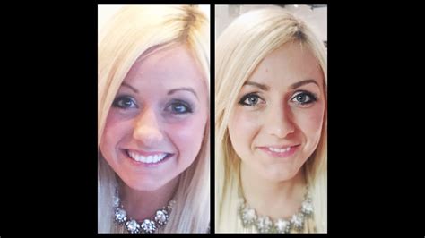 This content is not available due to your privacy preferences. Carly's Brow Transformation - YouTube