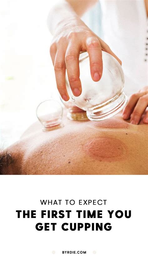 Here S What To Expect The First Time You Get Cupping Artofit