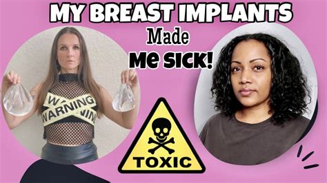 breast implants made me sick toxic beauty standards a conversation with sizehappy must