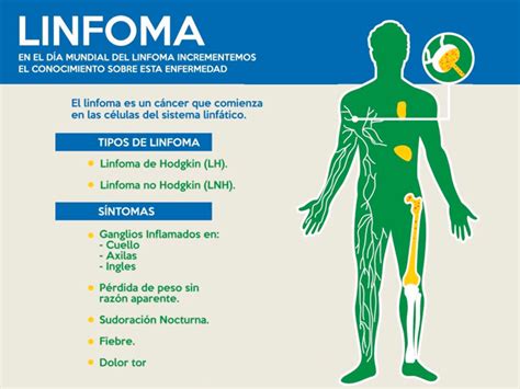 A to z list of cancer drugs. Salud: Cuidado con el linfoma, un tipo de cáncer muy ...