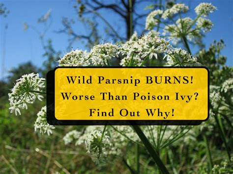 Wild Parsnip Burns Worse Than Poison Ivy Hg