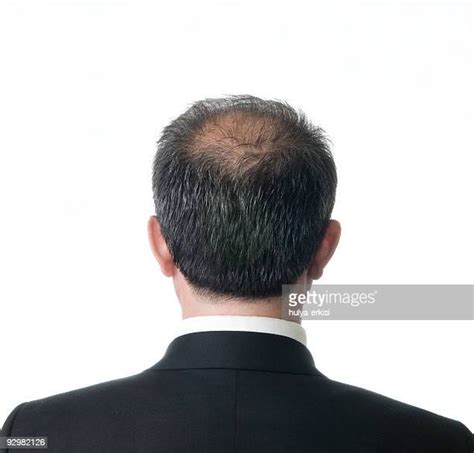 Bald Spot Photos And Premium High Res Pictures Getty Images