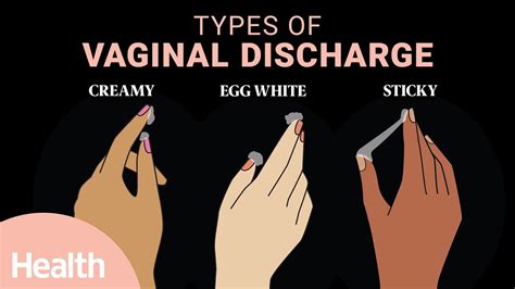 What Vaginal Discharge Says About Your Health Deep Dives Health
